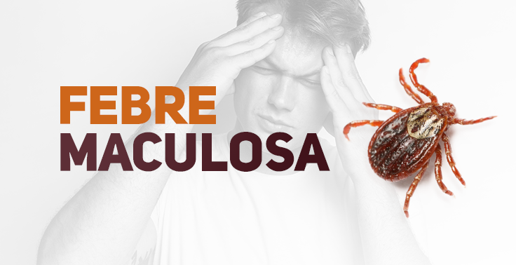 Imagem informativa de saúde com o texto FEBRE em laranja e MACULOSA em marrom no canto esquerdo. Ao fundo, uma pessoa segura a cabeça com as mãos, indicando dor de cabeça, enquanto no lado direito destaca-se a imagem em tom avermelhado de um carrapato.